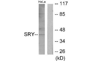 Western Blotting (WB) image for anti-Sex Determining Region Y (SRY) (Internal Region) antibody (ABIN1849548) (SRY Antikörper  (Internal Region))
