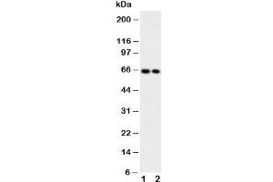 Western blot testing of CaMKK2 antibody and Lane 1:  rat brain;  2: mouse brain (CAMKK2 Antikörper  (Middle Region))