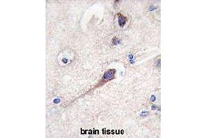 Formalin-fixed and paraffin-embedded human brain tissue reacted with HPCA polyclonal antibody  , which was peroxidase-conjugated to the secondary antibody, followed by DAB staining. (Hippocalcin Antikörper  (N-Term))