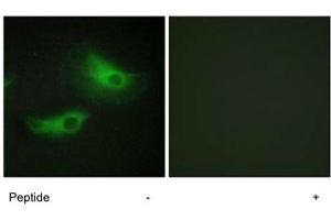Immunofluorescence analysis of HeLa cells, using ADD2 polyclonal antibody . (ADD2 Antikörper)