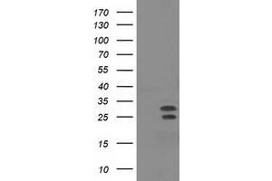 Western Blotting (WB) image for anti-Nonhomologous End-Joining Factor 1 (NHEJ1) antibody (ABIN1499730) (NHEJ1 Antikörper)