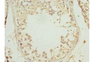 Immunohistochemistry of paraffin-embedded human testis tissue using ABIN7164276 at dilution of 1:100 (PRICKLE2 Antikörper  (AA 615-844))