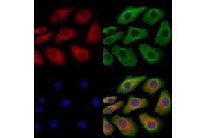 ABIN6265478 and ABIN6279868 staining Hela cells by IF/ICC.