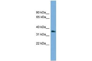 Western Blotting (WB) image for anti-Guanine Nucleotide Binding Protein (G Protein), beta Polypeptide 4 (GNB4) (Middle Region) antibody (ABIN2787271)