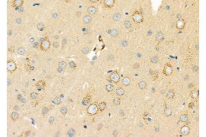ABIN6262120 and ABIN6273253 at 1/100 staining Rat brain tissue by IHC-P.