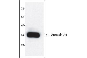 Antigen: Colo 205 cells lysate (Total protein per lane: 15 µg)  Primary Antibody: Anti-ANXA4 monoclonal (PA351-29. (Annexin IV Antikörper)