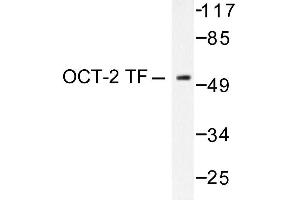 Image no. 1 for anti-POU domain, class 2, transcription factor 2 (POU2F2) antibody (ABIN271754) (Oct-2 Antikörper)