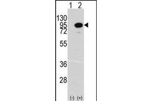 Western blot analysis of ACO2 (arrow) using rabbit polyclonal ACO2 Antibody (Center) (ABIN391809 and ABIN2841660). (ACO2 Antikörper  (AA 294-325))