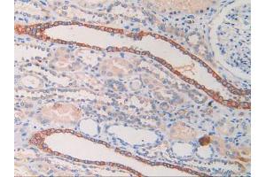 DAB staining on IHC-P; Samples: Human Kidney Tissue. (CYFRA21.1 Antikörper  (AA 244-400))
