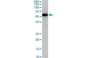 CDK8 monoclonal antibody (M02), clone 6E5. (CDK8 Antikörper  (AA 375-464))