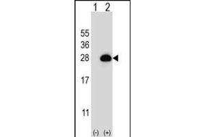 Western blot analysis of RAB3B (arrow) using rabbit polyclonal RAB3B Antibody (C-term) (ABIN656831 and ABIN2846040). (RAB3B Antikörper  (C-Term))