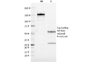 SDS-PAGE Analysis Purified CD1a Mouse Monoclonal Antibody (CB-T6). (CD1a Antikörper)