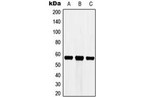 Western Blotting (WB) image for anti-Cytochrome P450, Family 3, Subfamily A, Polypeptide 7 (CYP3A7) (Center) antibody (ABIN7295436)