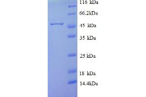 SDS-PAGE (SDS) image for Sulfite Oxidase (SUOX) (AA 1-416), (full length) protein (His tag) (ABIN5711821)