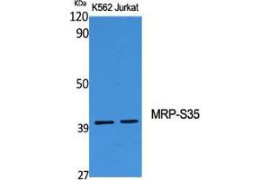Western Blot (WB) analysis of specific cells using MRP-S35 Polyclonal Antibody.