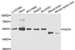 Western blot analysis of extracts of various cell lines, using FSCN1 antibody. (Fascin Antikörper  (AA 394-493))