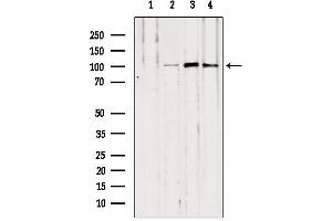 Western blot analysis of extracts from various samples, using NOD2 antibody.