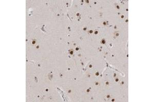 Immunohistochemical staining of human cerebral cortex with CXorf23 polyclonal antibody  shows strong nuclear positivity in neuronal cells. (CXORF23 Antikörper)