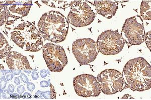 Immunohistochemical analysis of paraffin-embedded mouse testis tissue. (CDX2 Antikörper)