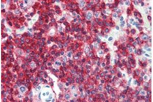 Anti-CD45RA antibody IHC staining of human spleen. (CD45RA Antikörper  (FITC))