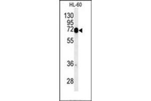 Western blot analysis of Complex IV subunit I Antibody  in HL-60 cell line lysates (35ug/lane). (Complex IV Subunit I (AA 202-232), (Middle Region) Antikörper)