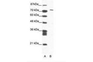 Image no. 1 for anti-Mastermind-Like Domain Containing 1 (MAMLD1) (AA 180-229) antibody (ABIN202873)
