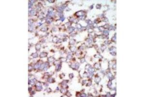 Image no. 2 for anti-Mitogen-Activated Protein Kinase Kinase Kinase 7 (MAP3K7) (C-Term) antibody (ABIN360354)