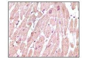 Immunohistochemical analysis of paraffin-embedded human normal cardiac muscle tissue, showing cytoplasmic localization using cTnI antibody with DAB staining. (TNNI3 Antikörper)