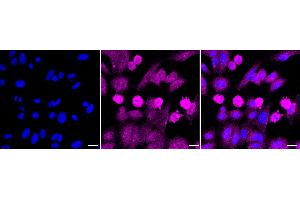 Immunocytochemical staining of HepG2 cells with FLT1 antibody (ABIN7798635), 1:1,000). (Rekombinanter FLT1 Antikörper)