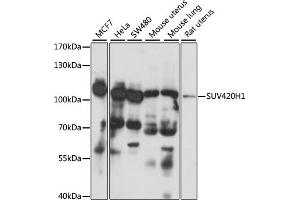 Western blot analysis of extracts of various cell lines, using SUV420H1 antibody (ABIN7270648) at 1:1000 dilution. (SUV420H1 Antikörper  (AA 100-200))