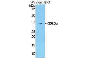 Western blot analysis of the recombinant protein. (SULT1A1 Antikörper  (AA 3-291))