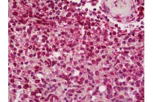 Anti-BCAR1 / p130Cas antibody IHC staining of human spleen. (BCAR1 Antikörper  (AA 275-325))