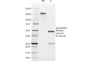 SDS-PAGE (SDS) image for anti-CD47 (CD47) antibody (ABIN6941211)