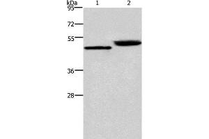 Western Blot analysis of Human stomach cancer and Mouse stomach tissue using Cathepsin E Polyclonal Antibody at dilution of 1:450