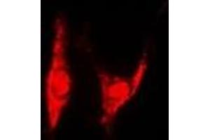 Immunofluorescent analysis of PSMD8 staining in U2OS cells.