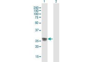 Western Blot analysis of C1QA expression in transfected 293T cell line by C1QA MaxPab polyclonal antibody. (C1QA Antikörper  (AA 1-245))