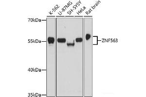 Western blot analysis of extracts of various cell lines using ZNF563 Polyclonal Antibody at dilution of 1:1000. (ZNF563 Antikörper)