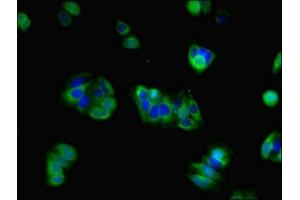 Immunofluorescent analysis of HepG2 cells using ABIN7153987 at dilution of 1:100 and Alexa Fluor 488-congugated AffiniPure Goat Anti-Rabbit IgG(H+L) (NMDAR2A Antikörper  (AA 501-750))