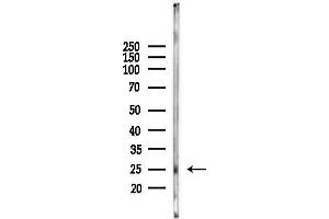 anti-Claudin 3 (CLDN3) (C-Term) antibody