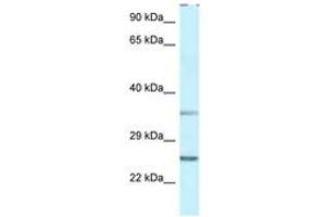 Image no. 1 for anti-Protein Phosphatase 1, Regulatory (Inhibitor) Subunit 2 (PPP1R2) (AA 27-76) antibody (ABIN6747489) (PPP1R2 Antikörper  (AA 27-76))