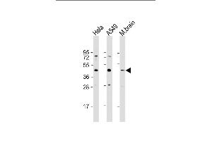 All lanes : Anti-G6PC3 Antibody (C-Term) at 1:1000 dilution Lane 1: Hela whole cell lysate Lane 2: A549 whole cell lysate Lane 3: mouse brain lysate Lysates/proteins at 20 μg per lane.