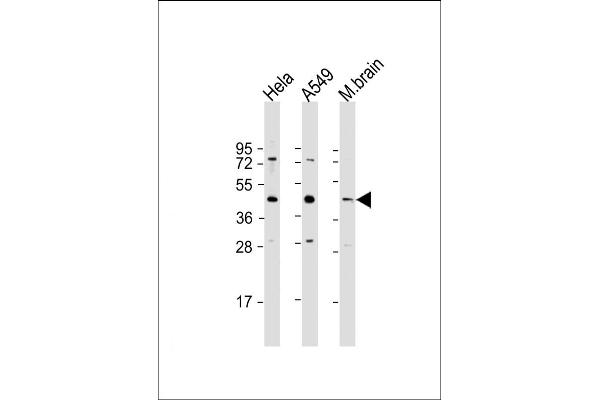 G6PC3 Antikörper  (AA 215-246)