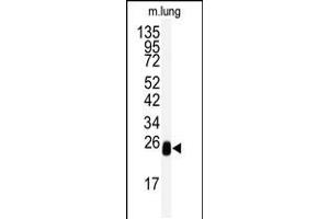 Western blot analysis of anti-DCXR Antibody in mouse lung tissue lysates (35ug/lane) (Doublecortin Antikörper  (AA 79-106))