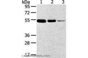 Western blot analysis of Human thyroid and esophagus cancer, human normal rectum tissue, using TMPRSS11F Polyclonal Antibody at dilution of 1:500 (TMPRSS11F Antikörper)