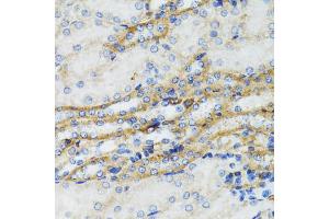 Immunohistochemistry of paraffin-embedded mouse kidney using SERPING1 antibody (ABIN6290125) at dilution of 1:100 (40x lens). (SERPING1 Antikörper)