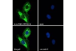 (ABIN185483) Immunofluorescence analysis of paraformaldehyde fixed U2OS cells, permeabilized with 0.