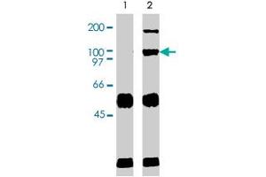 Immunoprecipation results using western blot analysis. (VAV2 Antikörper  (AA 287-578))