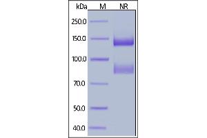 Biotinylated Human ITGAV&ITGB6 Heterodimer Protein, His,Avitag&Tag Free on  under ing (NR) condition. (ITGAV/ITGB6 Protein (AA 31-992) (His tag,AVI tag,Biotin))