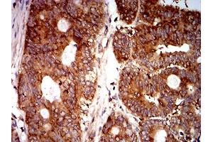 Immunohistochemistry (IHC) image for anti-Eukaryotic Translation Initiation Factor 5 (EIF5) (AA 1-300) antibody (ABIN5865324) (EIF5 Antikörper  (AA 1-300))