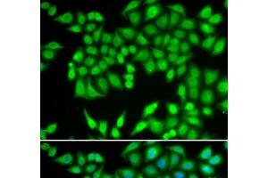 Immunofluorescence analysis of U2OS cells using MCM3 Polyclonal Antibody (MCM3 Antikörper)
